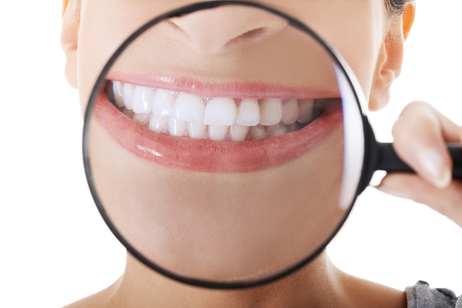 Dental Crown Durability: What You Need to Know About Their Lifespan and Care