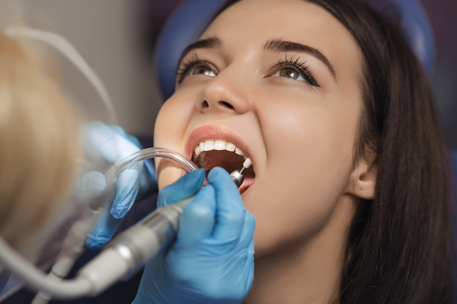 Preventing Dental Emergencies: Tips for Avoiding Common Issues