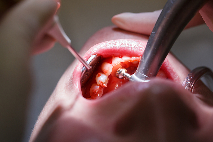 Comprehensive Periodontics and Gum Care in Fairfield, CA for a Healthy Smile