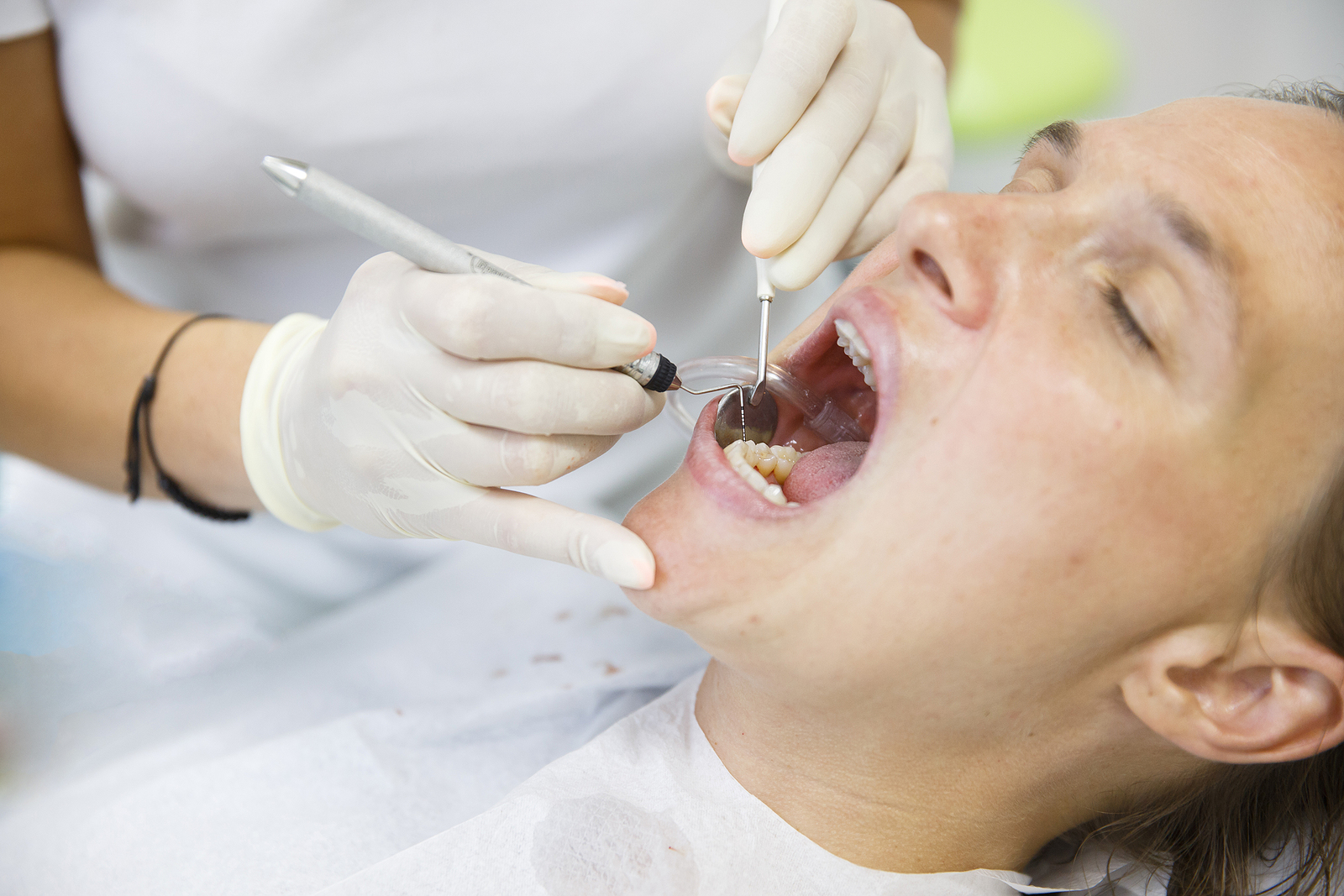 Root Canal Aftercare 101: Essential Tips for a Smooth Recovery